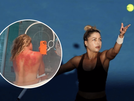 Renata Zarazúa sufre quemaduras por el excesivo sol de Australia. Captura de pantalla.